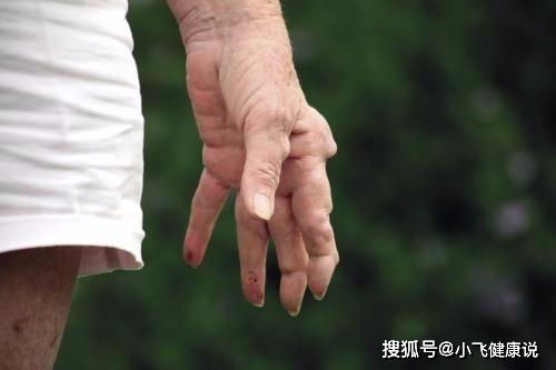 口腔溃疡反复发作,或许是这6种疾病的预示,别忽视